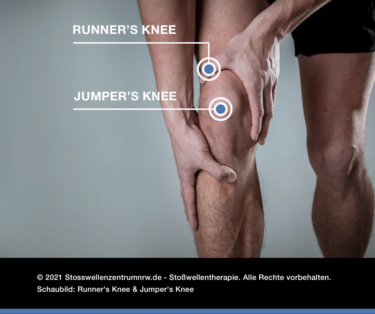 📶 Runner’s Knee - Alle Infos zur Therapie beim Läuferknie